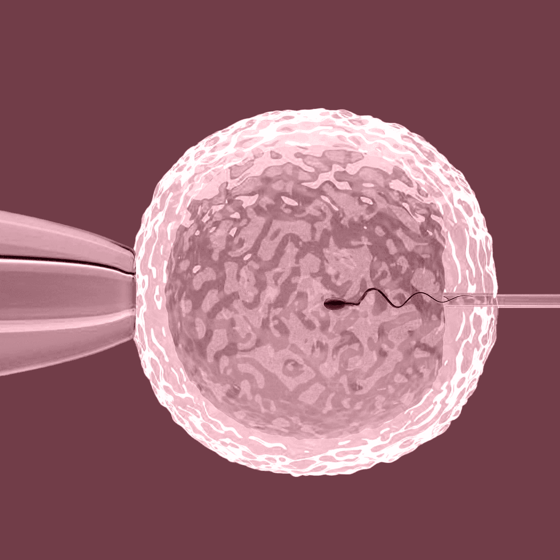 IVF Treatment
